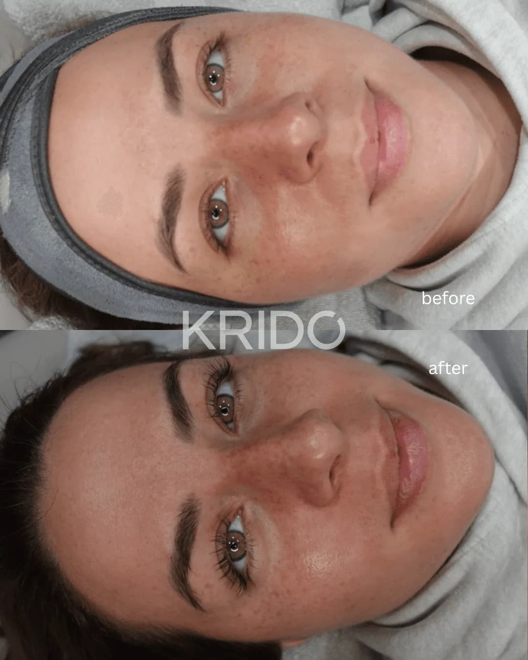 Client’s face before and after brow shaping and a lash lift at KRIDO Wellness, showing cleaner brow definition